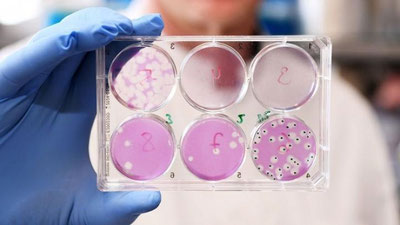 'Дунёда “омикрон”нинг янада юқумли мутацияси тарқалмоқда'ning rasmi