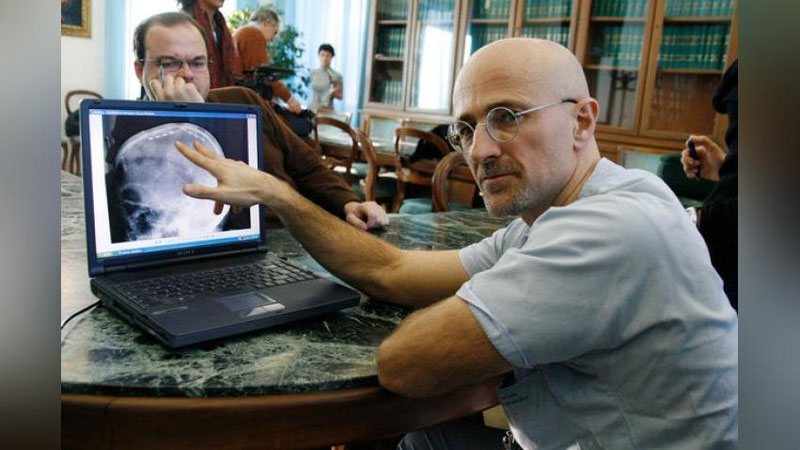 Изрображение 'ИТАЛЬЯНСКОМУ ХИРУРГУ УДАЛОСЬ ПЕРЕСАДИТЬ ГОЛОВУ'