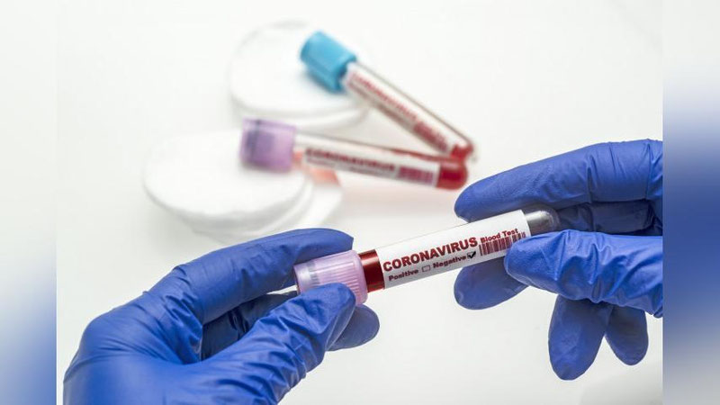 'Koronavirus infeksiyasini aniqlash uchun necha ming hamyurtimizda test o`tkazilgan?'ning rasmi
