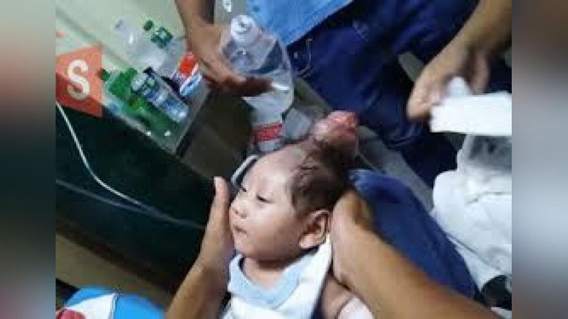 'Филиппинда “Якка шохли” бола дунёга келди (Видео)'ning rasmi