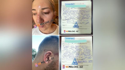 Изрображение 'Проводится проверка по заявлению об избиении двух граждан сотрудниками ОВД в Ташкенте'