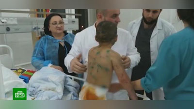 Изрображение 'Ожоги, укусы и перелом: в Ингушетии жестоко истязали 7-летнюю девочку (видео)'