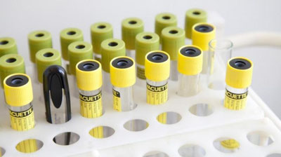 Изрображение 'НАЗВАН САМЫЙ СМЕРТОНОСНЫЙ ВИРУС НА ЗЕМЛЕ'