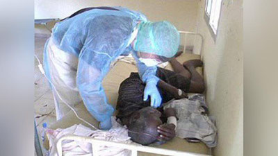 'Olimlar Ebola virusiga qarshi samarali dori vositasini yaratishdi'ning rasmi