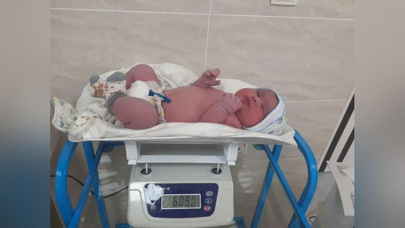 'Farg`onada 6 kg. 90 gramlik chaqaloq dunyoga keldi'ning rasmi