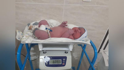 'Фарғонада 6 кг. 90 грамлик чақалоқ дунёга келди'ning rasmi