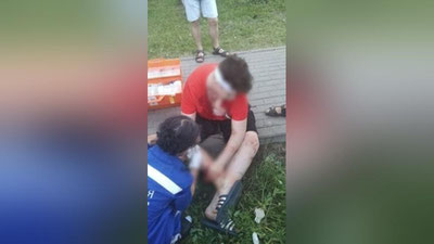 Изрображение 'В Подмосковье у школьника во рту взорвалась электронная сигарета: подросток получил увечья'