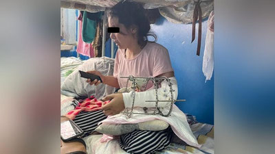 'Россияда тан жароҳати олган аёлга қарийб 5000 доллар компенсация ундириб берилди'ning rasmi