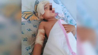 Изрображение 'В Андижане пятилетнего ребенка покусала стая собак'