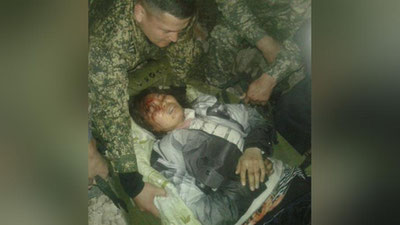 '4 метр баландликдан қулаб тушган қизнинг ҳаёти сақланиб қолинди (фото)'ning rasmi