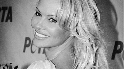 'Pamela Anderson klinikadan qo`ltiqtayoqda chiqdi (Foto)'ning rasmi