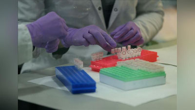 Изрображение 'В мире официально доказан первый случай повторного заражения коронавирусом'