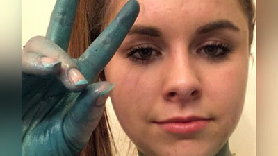 'Ванна қабул қилгандан кейин кўкариб кетган қиз ижтимоий тармоқ фойдаланувчиларининг кулгисига қолди'ning rasmi