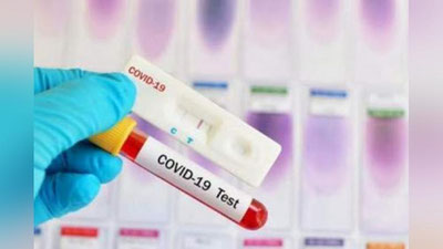 'TIV fuqarolarni soxta PZR-test ma`lumotnomalaridan ogohlantirdi'ning rasmi