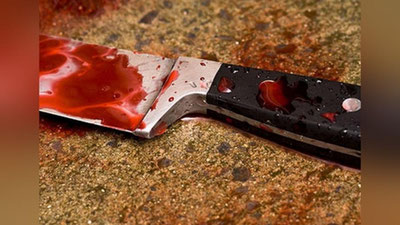 Изрображение 'ЖИТЕЛЬНИЦА СЫРДАРЬИНСКОЙ ОБЛАСТИ ЧУДОМ ВЫЖИЛА ПОСЛЕ НАПАДЕНИЯ ПАСЫНКА'