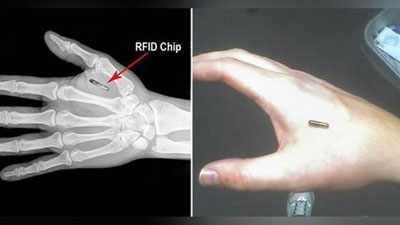 'Shvesiyada aholini ommaviy ravishda chiplashtirish boshlandi (Video)'ning rasmi