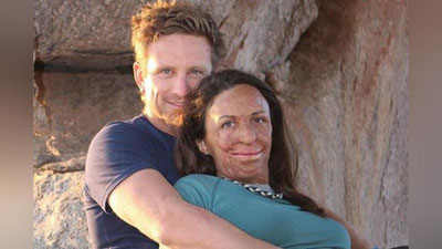 '​ЁНҒИНДА БУТУНЛАЙ ЁНИБ КЕТГАН МОДЕЛЬ — ТУРИЯ ПИТТ ЯҚИНДА ОНА БЎЛАДИ'ning rasmi