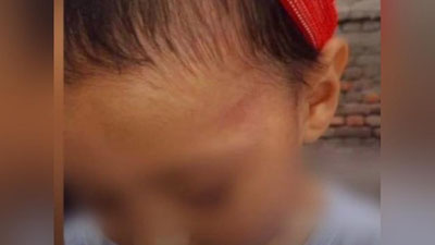 'Фарғонада дефектологнинг синглиси 3 ёшли болани калтаклади'ning rasmi