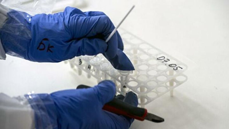 'Samarqandda 34 kishiga koronavirus yuqishiga sababchi bo`lgan tibbiyot xodimiga nisbatan jinoyat ishi qo`zg`atildi'ning rasmi