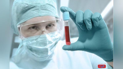 'Yurtimizda yana 65 kishida virus aniqlandi'ning rasmi