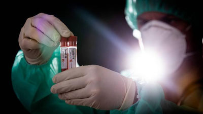 '24 soat ichida 14 qozog'istonlik koronavirus va pnevmoniyadan vafot etdi'ning rasmi