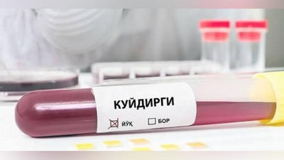 'Chiroqchida kuydirgi kasalligi qo`zg`atuvchisi aniqlanmadi'ning rasmi