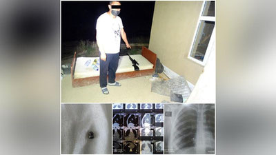 Изрображение 'Врачи в Карши спасли девушку, раненную в сердце из пневматической винтовки'