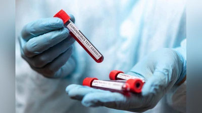 'O`zbekistonda 1 kunda 925 kishida koronavirus aniqlandi. 8 nafar bemor vafot etdi'ning rasmi