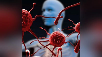 'ЖССТ: Неврологик касалликлар йилига 9 миллион беморнинг ўлимига сабаб бўлмоқда'ning rasmi