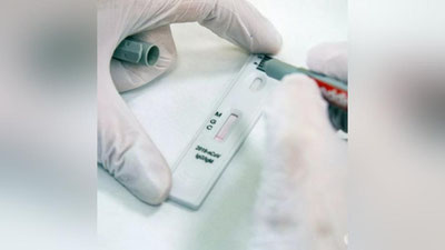'Koronavirus antigeni va antitanacha testlarini bir biridan farqi nimada?'ning rasmi