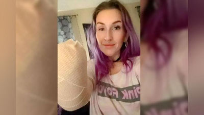 'Amerikalik ayol "fen" sabab bir qo`lidan ayrildi'ning rasmi