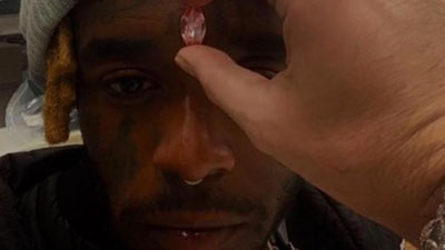 Изрображение 'Американский рэпер имплантировал в лоб бриллиант на $24 млн (видео)'