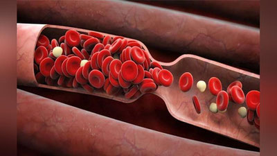 'Qonni suyultirishning organizm uchun foyda va zarari ma`lum qilindi'ning rasmi