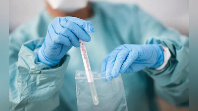 'Кеча Ўзбекистонда 230 нафарга яқин кишида коронавирус инфекцияси аниқланиб, яна 2 нафар бемор вафот этди'ning rasmi