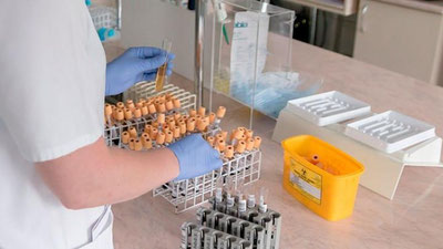 Изрображение 'Юная узбекистанка благополучно излечилась от "британского" штамма коронавируса'