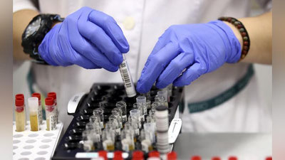 'Oʻzbekistonda 400 nafardan kamroq fuqaro koronavirus bilan kasallandi'ning rasmi