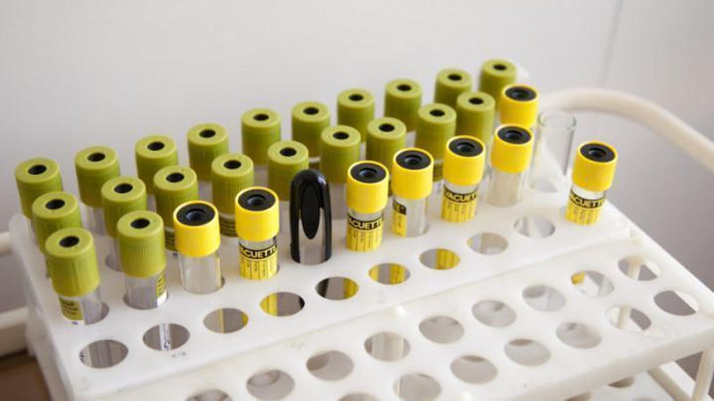 'Исроилда хориждан қайтган фуқароларида коронавируснинг янги тури аниқланди'ning rasmi