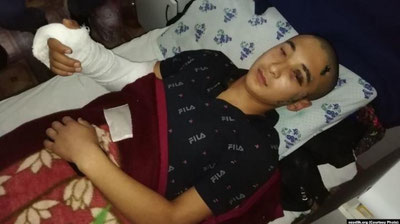 Изрображение 'В Иштыхане расследуют инцидент с выпавшим из окна школы подростком'