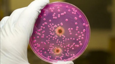 'Касаллик чақирувчи замбуруғлар инсон организмига қандай ўтади?'ning rasmi