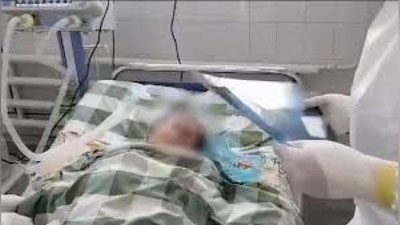 'O`z sog`ligiga e`tiborsizlik bilan qaragan bemorda koronivirus og`ir kechmoqda (Video)'ning rasmi