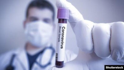 'Koronavirusda antibiotiklarni tavsiya qilish uchun qanday asoslar bo`lishi kerak?'ning rasmi