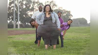 '​Amerikalik ayol rekord uchun sonining yo`g`onligini 2,5 metrga etkazishga qaror qildi'ning rasmi