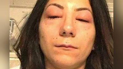 'Киприк узайтирган қизнинг кўзлари очилмай қолди'ning rasmi