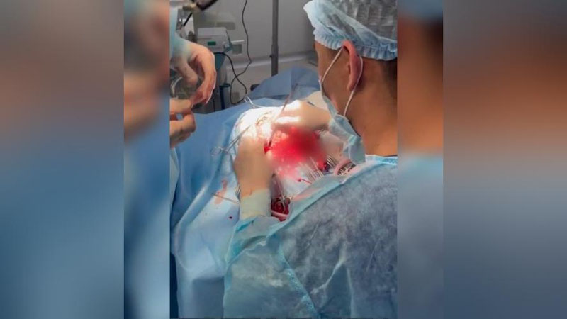 'Қозоғистонлик 10 ёшли болада мия эхинококкози аниқланган'ning rasmi