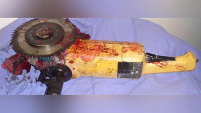 Изрображение 'ЖИТЕЛЬНИЦА СЛОВЕНИИ ОТРЕЗАЛА СЕБЕ КИСТЬ РУКИ РАДИ СТРАХОВКИ'