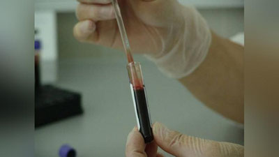 Изрображение 'Ученые исследовали редчайшую группу крови, названную "золотой"'