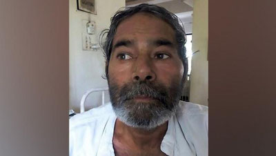 Изрображение 'В ИНДИИ РЕНТГЕН ВЫЯВИЛ 75 БУЛАВОК В ТЕЛЕ ПАЦИЕНТА (ФОТО)'