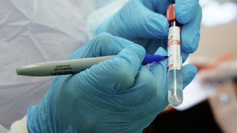 'Korxona yoki tashkilot ishchisida koronavirus aniqlansa, ular korxona hisobidan davolanadimi?'ning rasmi