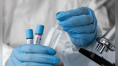 'Koronavirus: kunlik ko`rsatkichlar ketma-ket 3 kunlik ko`tarilishdan so`ng biiroz pasaydi'ning rasmi