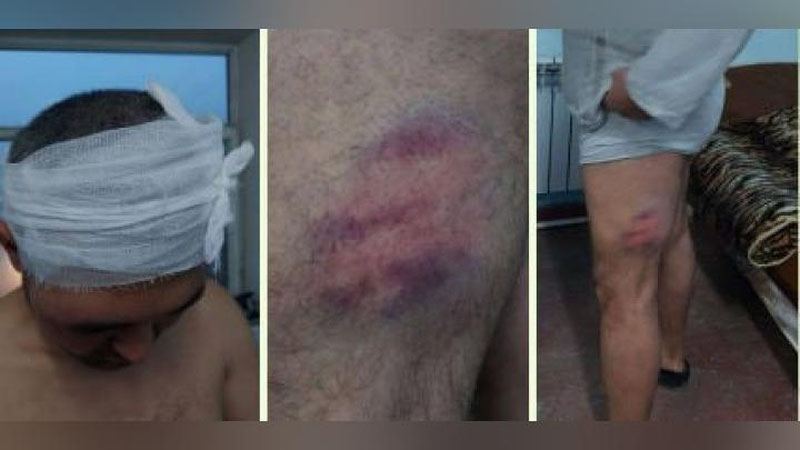 'Andijondagi gaz zapravkada navbat talashgan fuqarolar janjallashib ketdi'ning rasmi